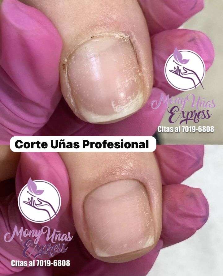 Corte de Uñas Profesional / Corrección Estructura