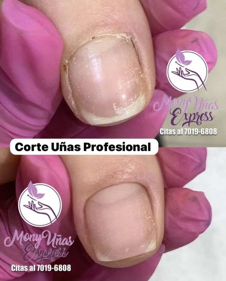 Corte de Uñas Profesional / Corrección Estructura